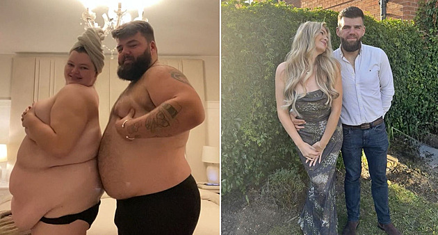 Z tlouštíků štíhlí snoubenci. Pár si dopřál společnou plastiku